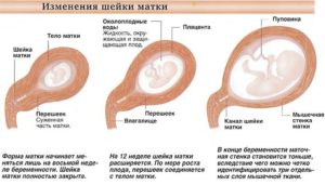 Какие ощущения в матке на ранних сроках беременности