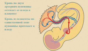 2 сосуда в пуповине при беременности мнение врачей