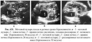 Размеры мочевого пузыря у плода по неделям нормы