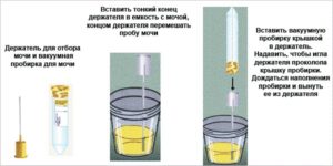 Сколько мл нужно для анализа мочи при беременности