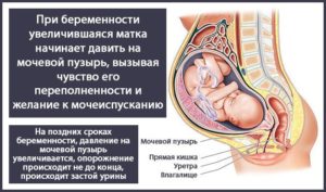 Болит матка при беременности почему