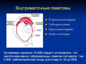 Ретроамниотическая гематома при беременности что это такое