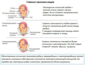 Как выглядят схватки перед родами у первородящих