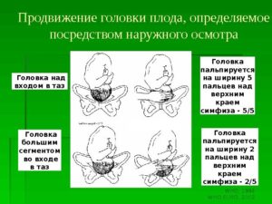 Головка плода низко расположена на 32 неделе беременности