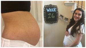 26 неделя беременности двойня