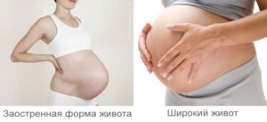 По форме живота определить пол ребенка при беременности