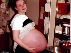 Токсикоз при беременности двойней