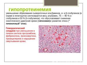 Альбумин понижен при беременности