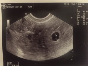 Во сколько недель можно увидеть на узи эмбрион