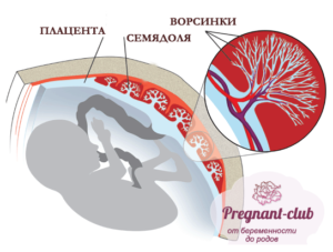 Плацента при беременности утолщена