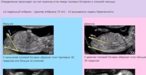 Можно ли определить пол ребенка на 14 неделе