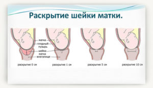 На сколько сантиметров должна раскрыться матка при родах