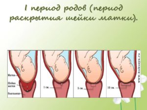 Шейка 1 см раскрытие 1 палец когда рожать