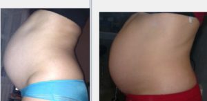 Памперс 17 недель беременности
