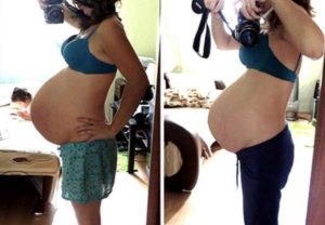 Каменеет живот на 40 неделе беременности когда рожать