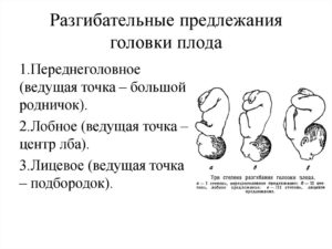 Разгибательные предлежания плода реферат