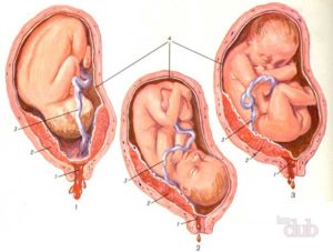 Плацента по передней стенке и шевеления плода форум