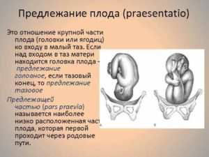 Низкое положение головки плода