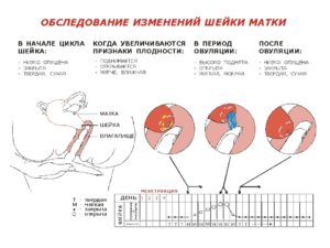 Как определить шейку матки самостоятельно