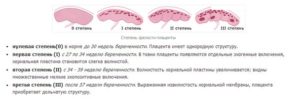 Диффузные изменения плаценты в 3 триместре что это