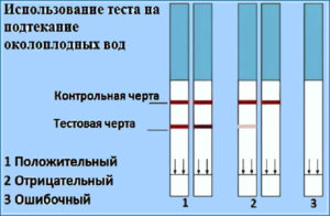 Как выглядят околоплодные воды при подтекании какого цвета