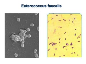 В моче e faecalis