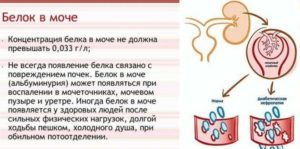 Как вывести белок из мочи при беременности