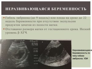 Признаки беременности на 6 неделе