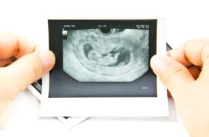 Беременность 5 недель на узи не видно эмбриона
