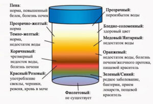 Моча оранжевого цвета у женщин при беременности