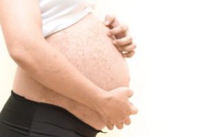 Лечение при беременности крапивница