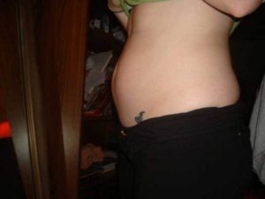 Молочница 38 неделя беременности