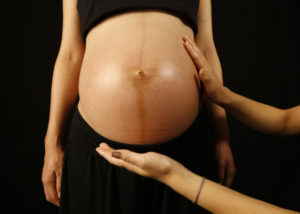 Полоска на животе у беременных