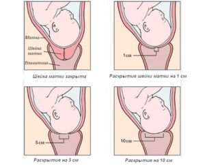 Осмотр шейки перед родами
