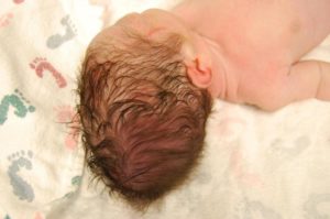 У новорожденного голова вытянута назад