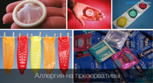 Аллергия на презерватив как проявляется