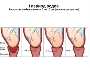 Сколько должно быть открытие шейки матки при родах