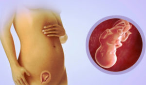 Токсикоз на 10 неделе беременности начался