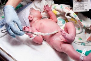 Как перевязать пуповину новорожденному