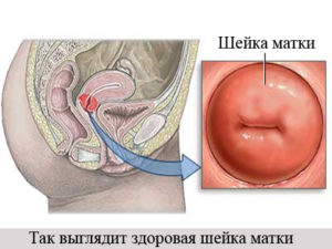 Матка сомкнута что это