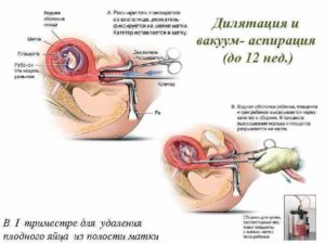 После миролюта нет выделений