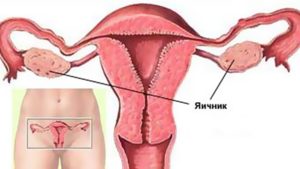 Яичник покалывает после овуляции