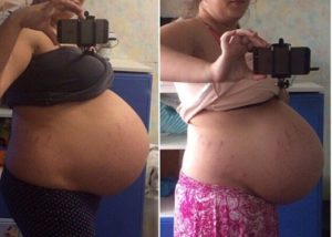 Опустился живот при второй беременности когда рожать