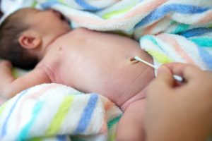 Через сколько заживает пупок у новорожденного после отпадения