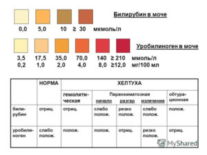 В моче уробилиноген следы