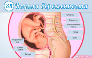 Как лежит ребенок в 35 недель беременности