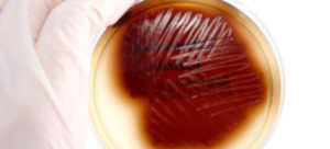 Enterococcus faecalis 10 3 в моче у ребенка