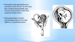 В области шеи петля пуповины при головном предлежании
