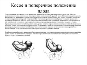 Поперечное положение плода в 32 недели причины