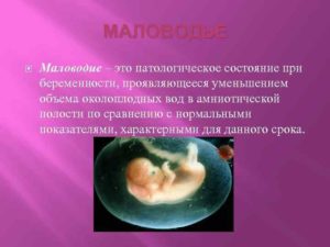 Маловодие при беременности причины и последствия 38 недель